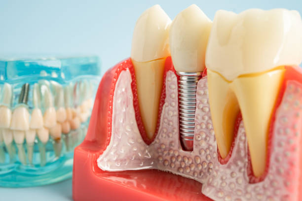 Best Dental Studio in Janesville, CA